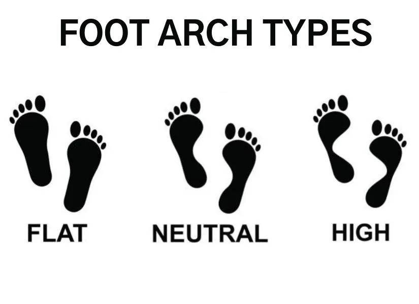 Foot arch types